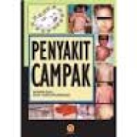 Image of PENYAKIT CAMPAK